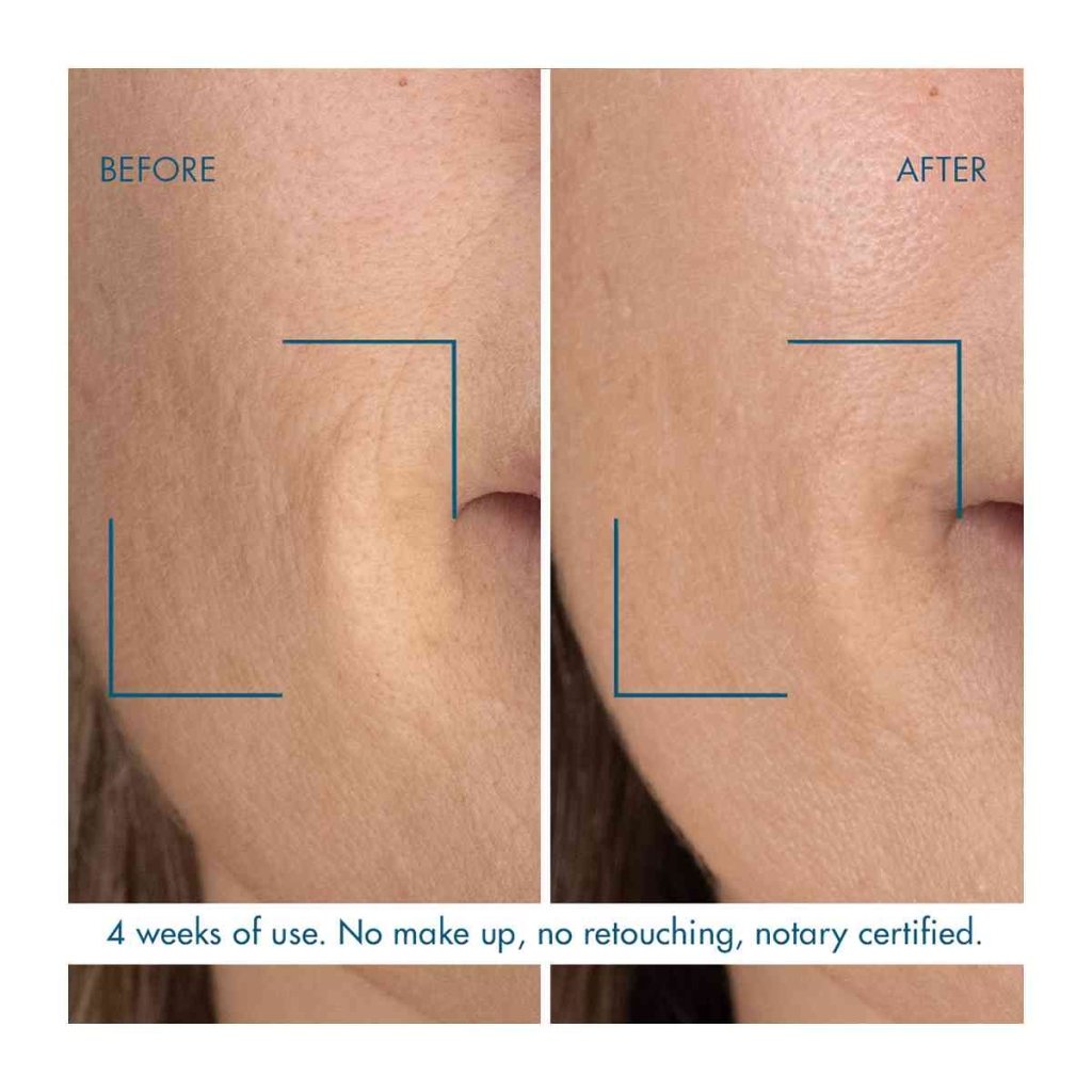 Biotherm Blue Thera Retinol Night Concentrate MV 30ml - Fragrance London