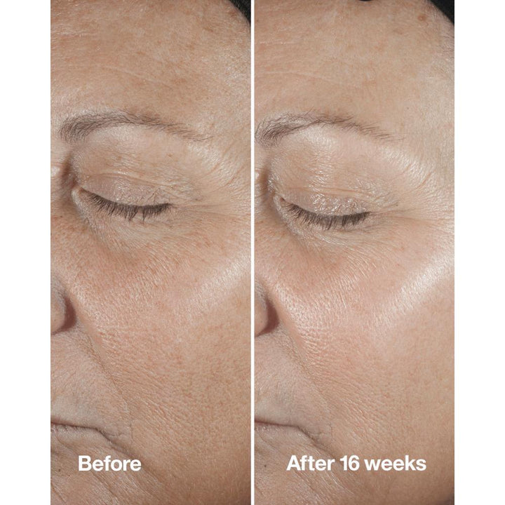 Clinique Smart Clinical Repair Wrinkle Correcting Serum 50ml - Fragrance London