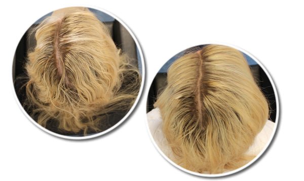 Reseed R12 Tri Peptide Hair Growth Serum for Women 30 ml - Fragrance London