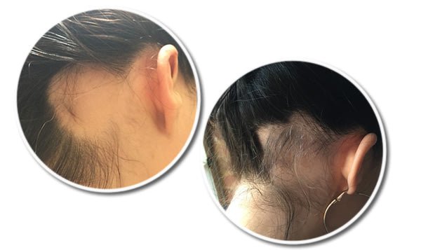 Reseed R12 Tri Peptide Hair Growth Serum for Women 30 ml - Fragrance London