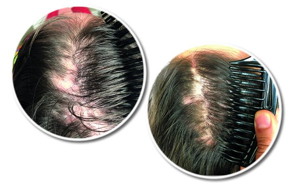 Reseed R12 Tri Peptide Hair Growth Serum for Women 30 ml - Fragrance London