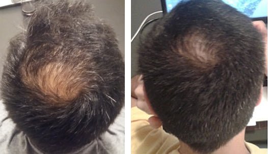 RESEED R8 Botanical Solution for Men 50 ml - Fragrance London