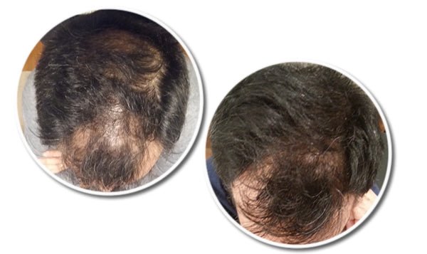 RESEED Sabal and Neem Fortifying Shampoo for Men - Fragrance London